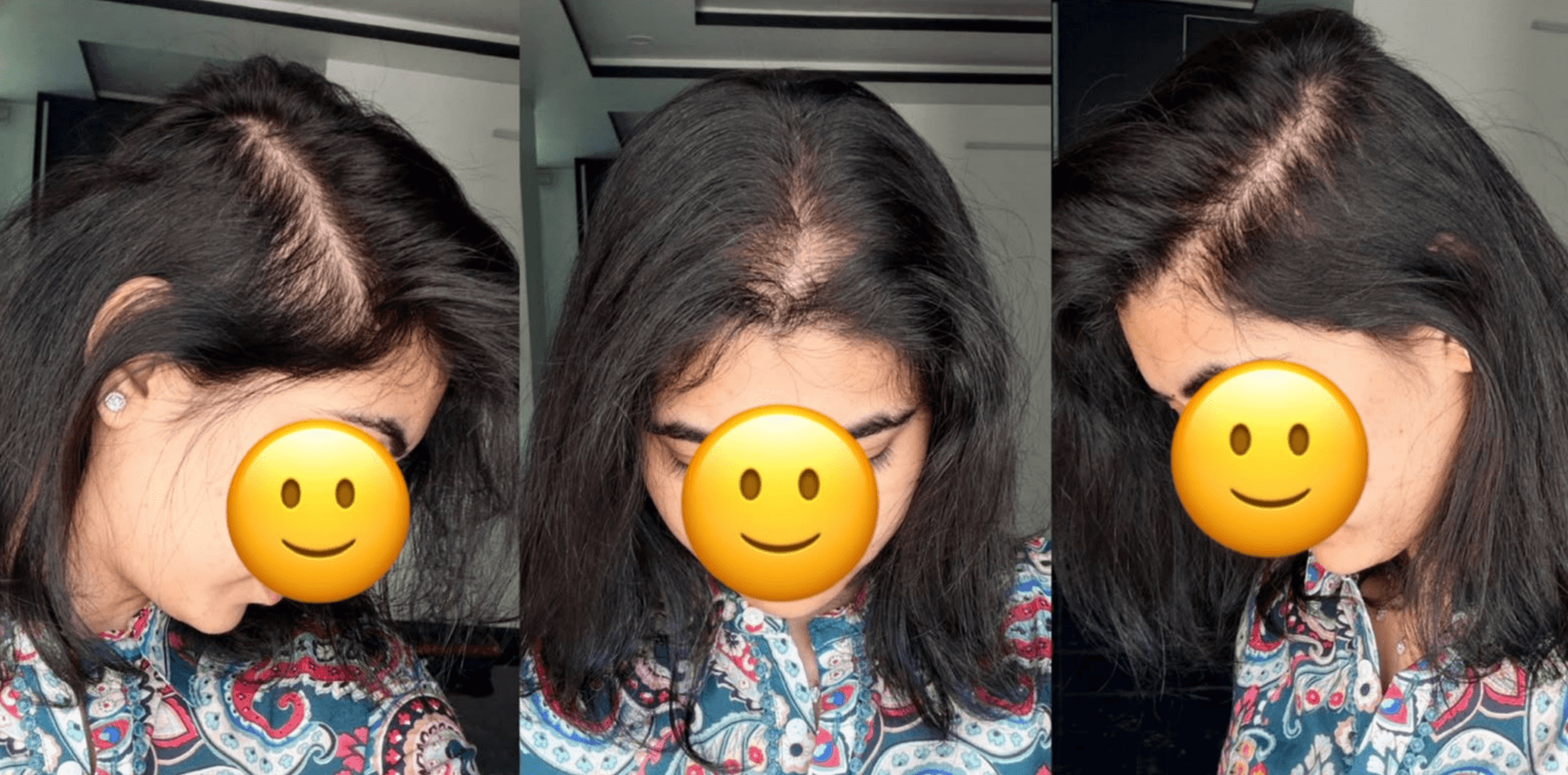 After treatment
