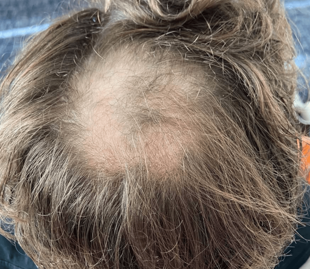 Before treatment